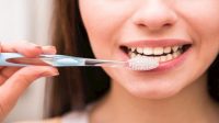 Simak Ini 9 Cara Mudah Memutihkan Gigi
